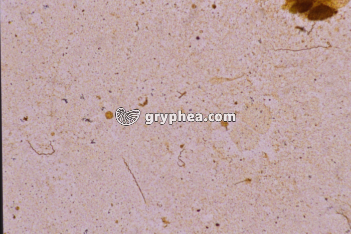 Tréponème pâle de la Syphilis (Spirochète) x100 - gryphea.com